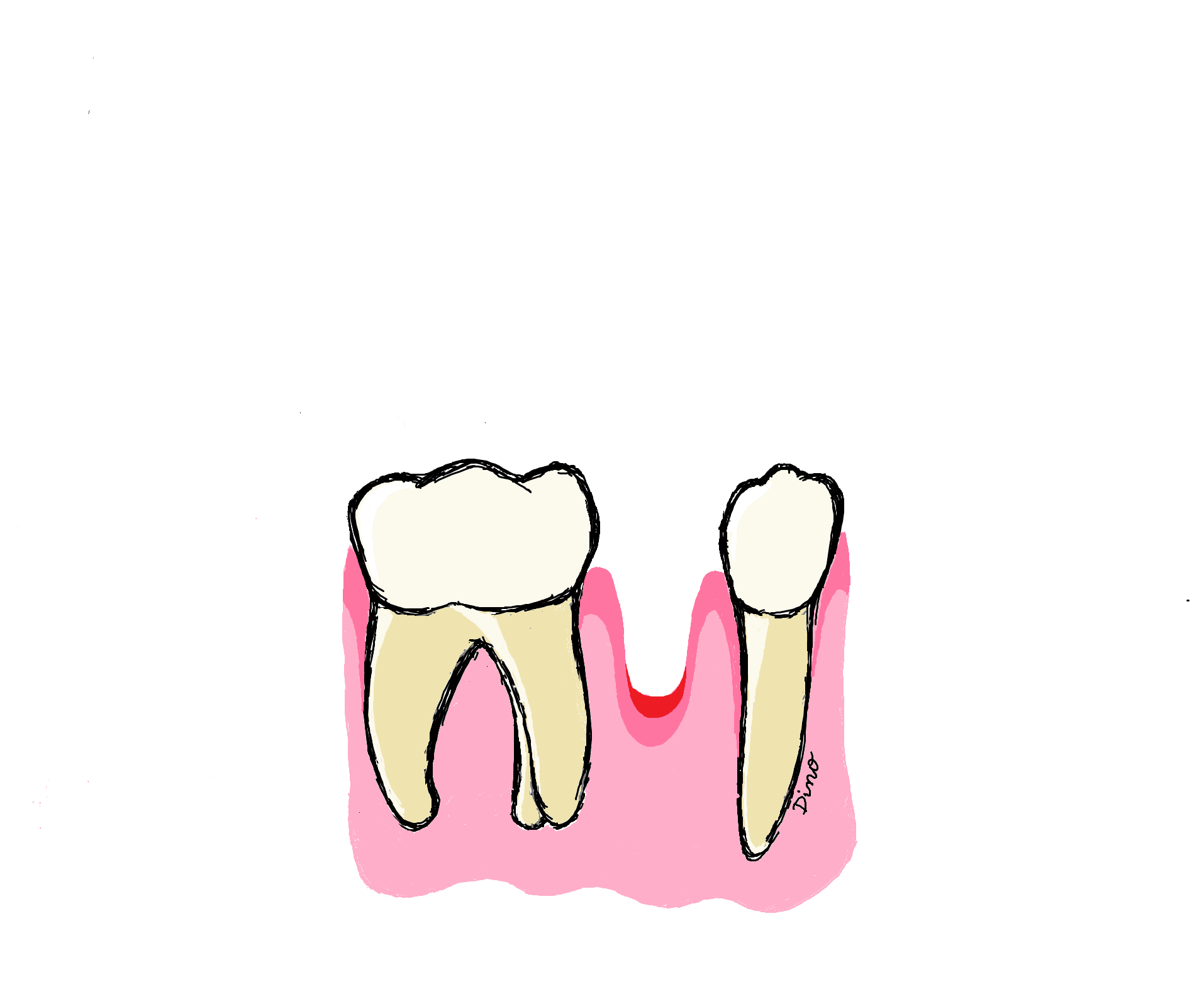 EXTRACTIONS